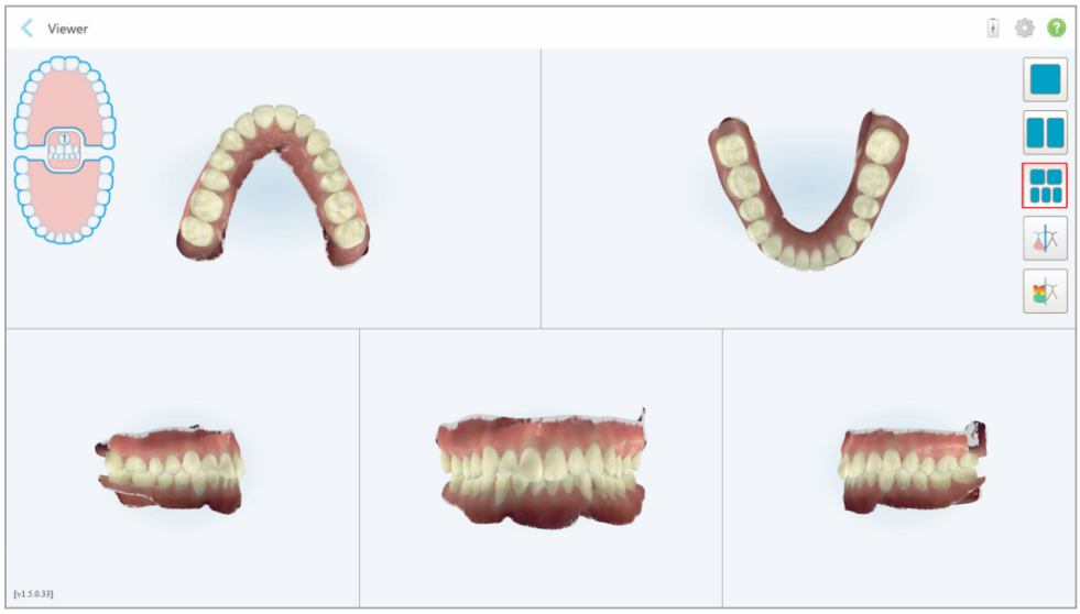 디지털_교정